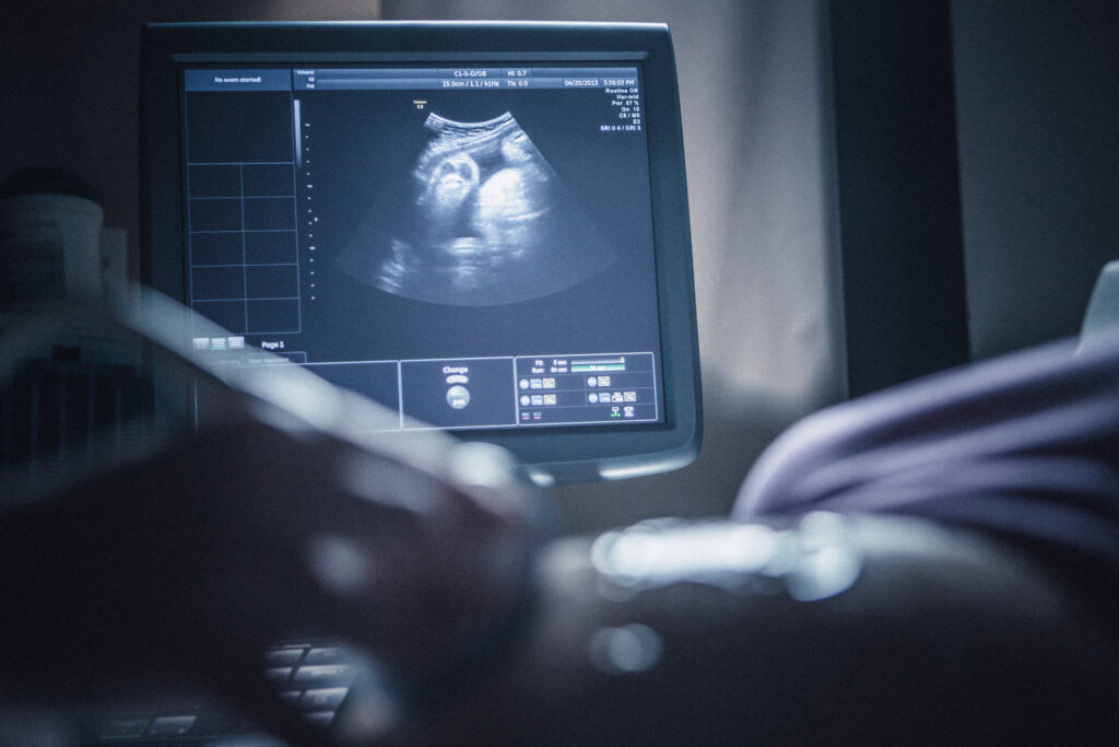 Preparing for Ultrasound Diagnostics